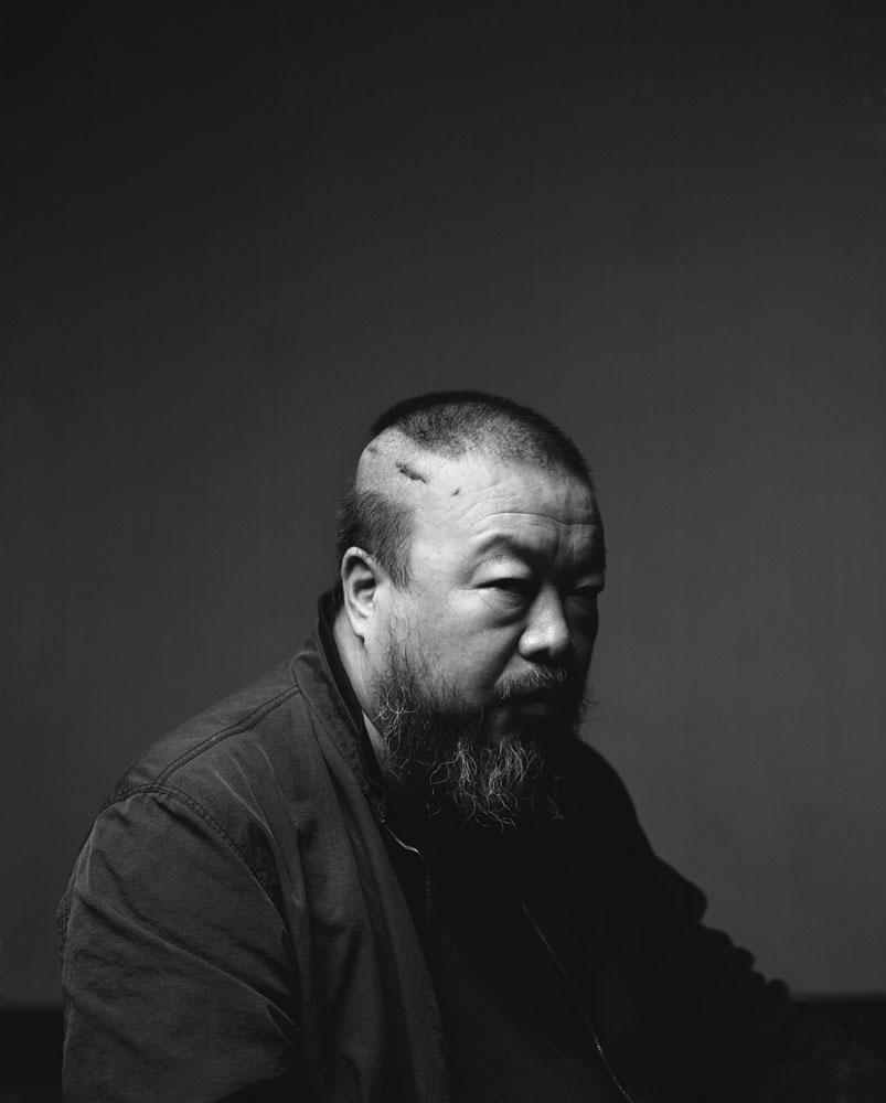 A 2010 portrait of Ai Weiwei. The scar is from treatment of a brain hemorrhage sustained after a beating by Chinese police. Photo: © Gao Yuan.