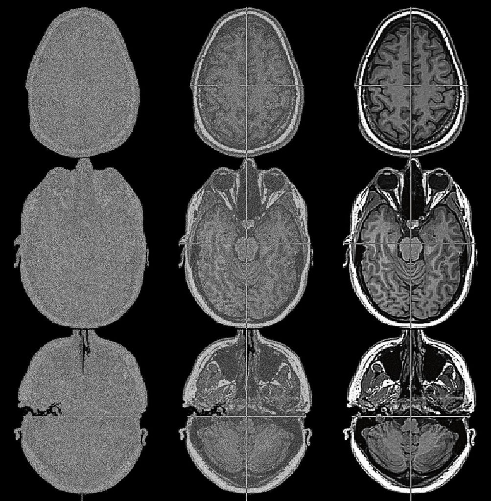 Sally McKay audited a course in brain-scan technology at York University in 2010. As part of the course, students in the class designed experiments for the MRI scanner, and then went into the scanner to be subjects for each other’s projects. These images are Sally’s brain, scanned during one of her fellow students’ experiments. 