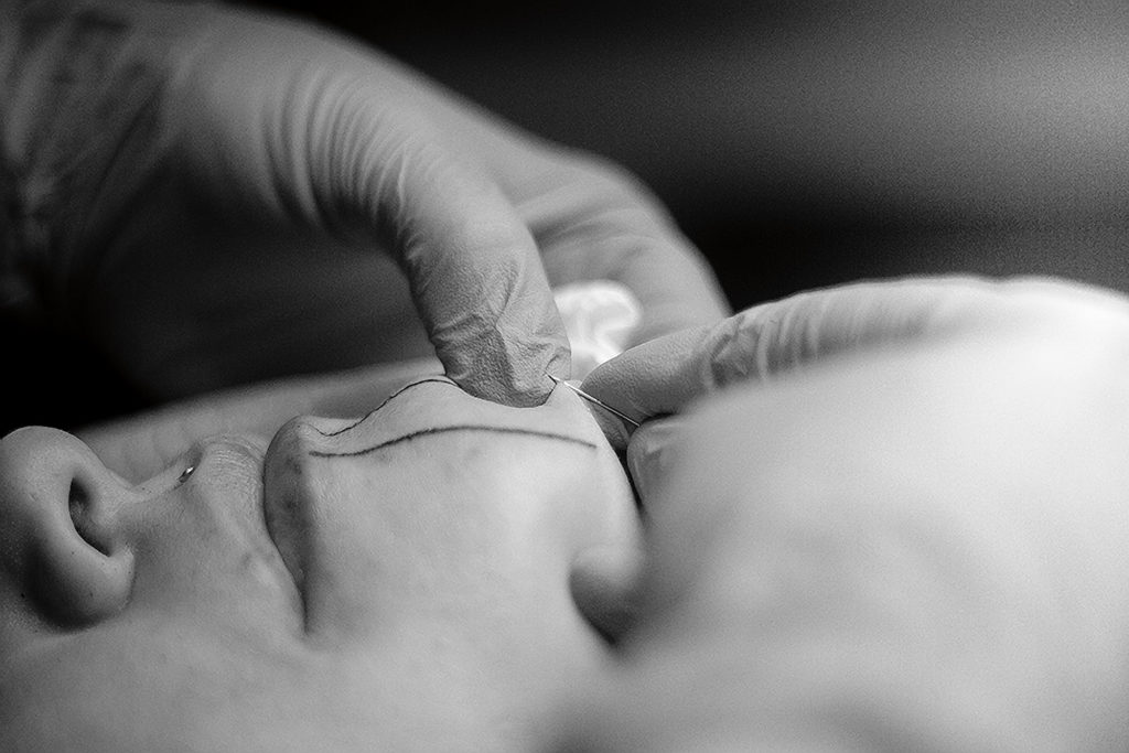 Skin-stitching a talloquteq. Photo: Per-Erik Dahlman.